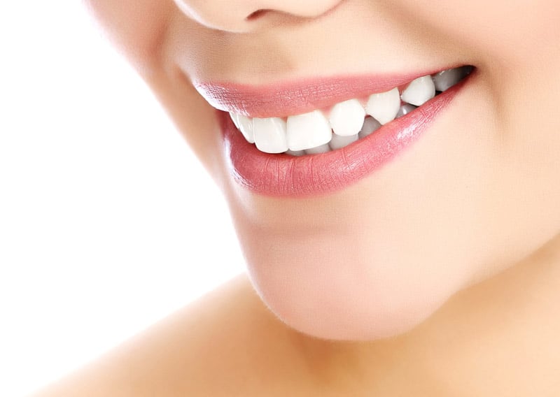 Top tratamientos de estética dental