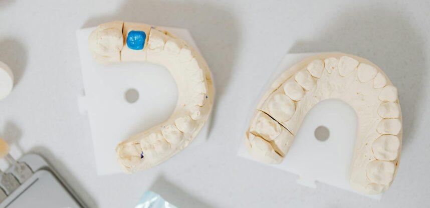 Tipos de implantes dentales