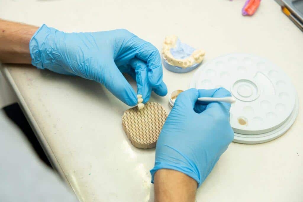 implantes dentales